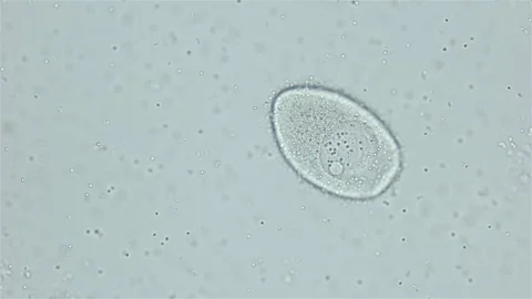 Sperm and ovule of worm Polychaeta Ophelia limacina under microscope, Opheliidae Stock Footage 247712787