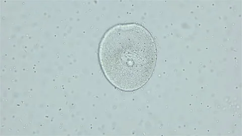 Sperm and ovule of worm Polychaeta Ophelia limacina under microscope, Opheliidae Stock Footage 248126207
