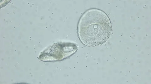 Sperm and ovule of worm Polychaeta Ophelia limacina under microscope, Opheliidae Stock Footage 248227045