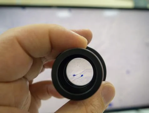 Sperm cells Stock Photos