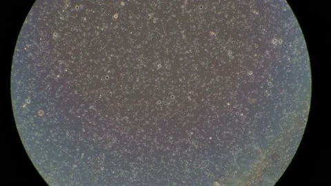 Sperm cells through microscope lens Stock Footage 159901109