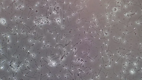 Sperm cells under microscope showing motility and reproduction concept. Stock Footage 331231337