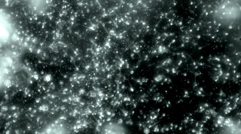 Sperm Count Sample Dark Field Microscope 4k Stock Footage 39391798