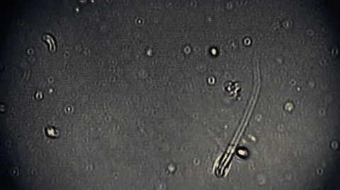Sperm Group of Sperms under micsorcope moving baby concept dna motherhood 動画素材 25605397