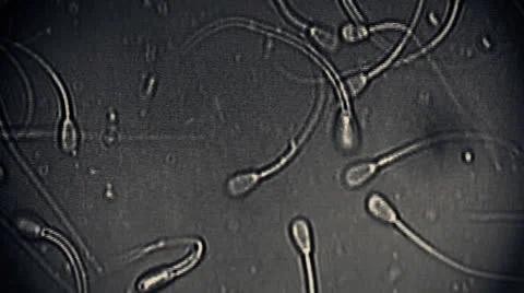 Sperm Group of Sperms under micsorcope moving baby concept dna motherhood 動画素材 25606134