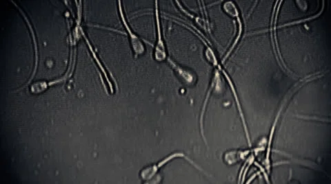 Sperm Group of Sperms under micsorcope moving baby concept dna motherhood 動画素材 25607469