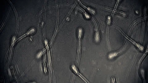 Sperm Group of Sperms under micsorcope moving baby concept dna motherhood 動画素材 25610973