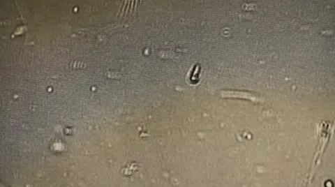 Sperm Group of Sperms under micsorcope moving baby concept dna motherhood 動画素材 25617515