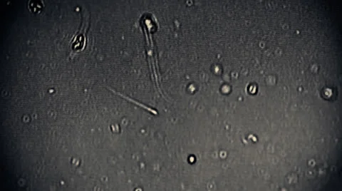 Sperm Group of Sperms under micsorcope moving baby concept dna motherhood 動画素材 25626226