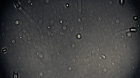 Sperm Group of Sperms under micsorcope moving baby concept dna motherhood 動画素材 25628130