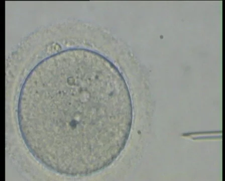 Sperm injection 2 스톡 동영상 69632