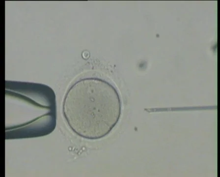 Sperm injection 스톡 동영상 69630