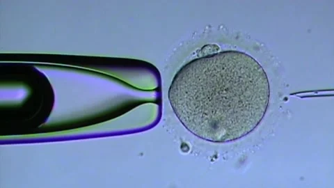 Sperm injection. Microscope lens in vitr... | Stock Video | Pond5