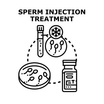 Sperm injection treatment for infertility conception process Stock Illustration