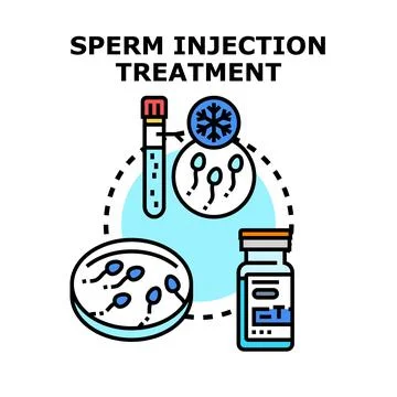 Sperm injection treatment for infertility conception process Stock Illustration