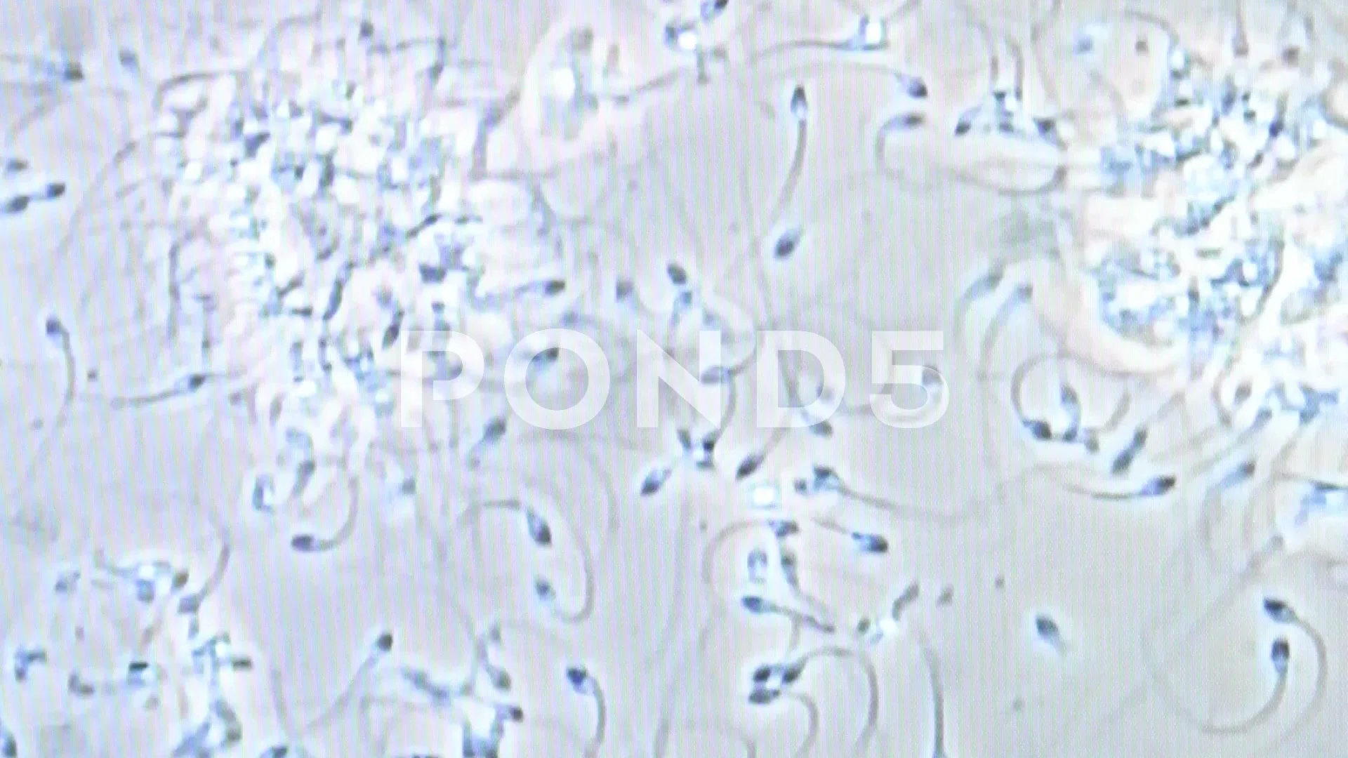 Sperm Microscope Spermatozoa Reprodu Stock Video Pond5