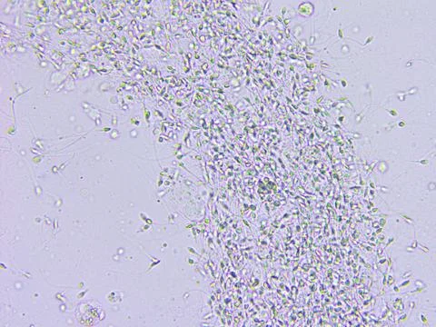 Sperm microscopic view Stock Photos