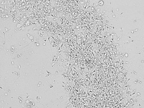 Sperm microscopic view Stock Photos