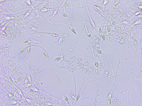 Sperm microscopic view Stock Photos