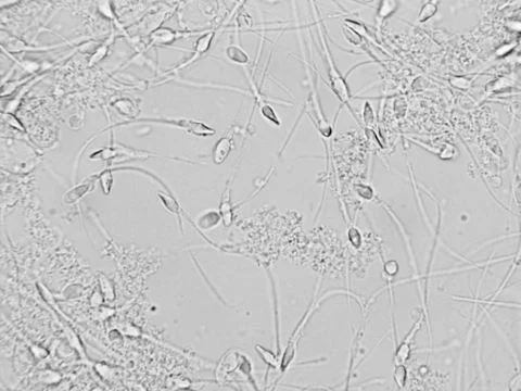 Sperm microscopic view Stock Photos