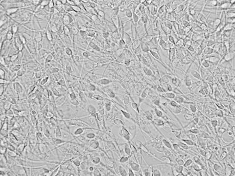 Sperm microscopic view Stock Photos