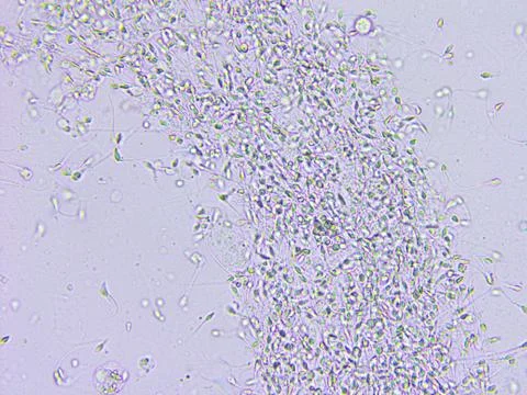 Sperm microscopic view Stock Photos