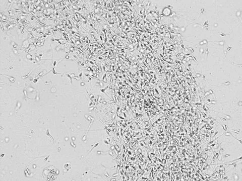 Sperm microscopic view Stock Photos