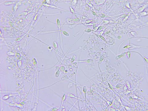 Sperm microscopic view Stock Photos