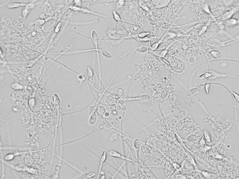 Sperm microscopic view Stock Photos