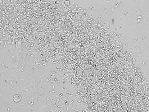 Sperm microscopic view Stock Photos