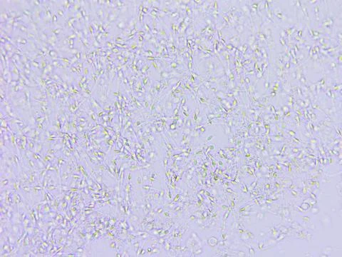 Sperm microscopic view Stock Photos