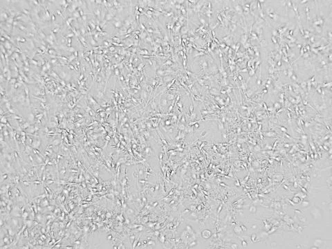 Sperm microscopic view Stock Photos