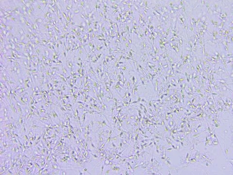 Sperm microscopic view Stock Photos