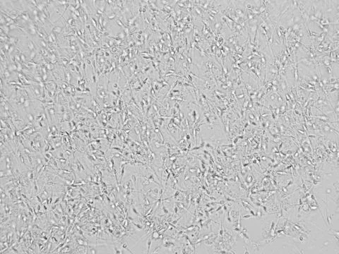 Sperm microscopic view Stock Photos