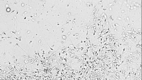 Sperm movement, microscope view Stock Footage 131437874