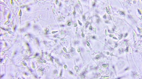 Sperm movement, microscope view Stock Footage 131437877
