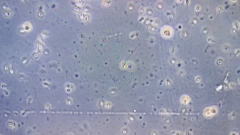 Sperm movements in microscope Stock Footage 147949411