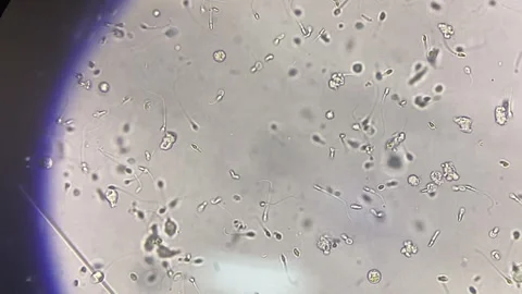 Sperm moving in fresh urine. Stock Footage 283532716