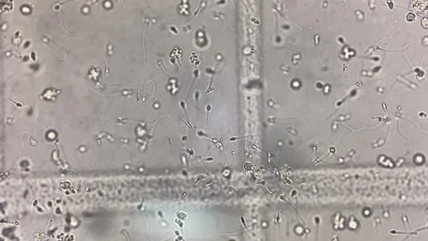 Sperm moving in fresh urine. Stock Footage 283532723