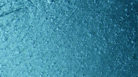 Sperm Sample Fertility Check 100x Phase Microscope With Fluorescent Light Stock Footage 77111987
