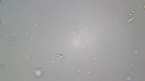 Sperm Sample seen under biological microscope. Stock Footage 63306649