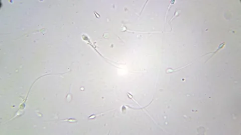 Sperm Sample seen under biological microscope. Stock Footage 63306656