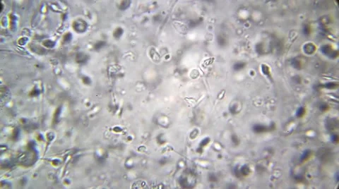 Sperm Sample seen under biological microscope. 動画素材 63306663