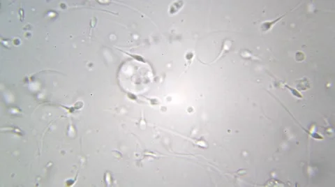 Sperm Sample seen under biological microscope. Stock Footage 63306689