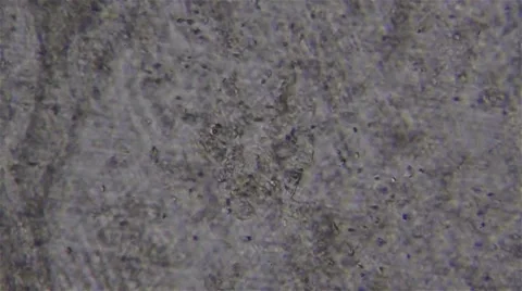 Sperm seen under the microscope Vídeo Stock 60781125