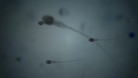Sperm seen under a microscope Stock Footage 150738868
