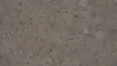 Sperm (spermatozoa) viewed under the microscope. Moving human sperm under Pha Video stock 97457843