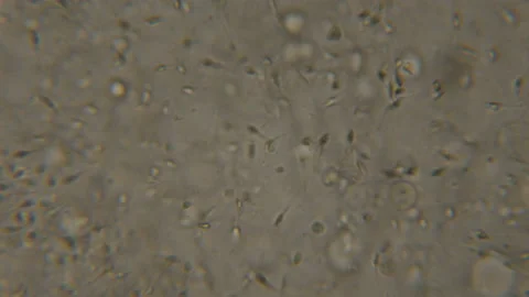 Sperm (spermatozoa) viewed under the microscope. Moving human sperm under Pha Video stock 98179866