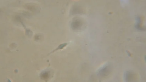 Sperm (spermatozoa) viewed under the microscope. Moving human sperm under Pha Stock Footage 101536473