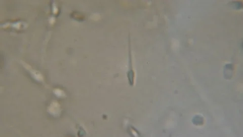 Sperm (spermatozoa) viewed under the microscope. Moving human sperm under Pha Video stock 107843529
